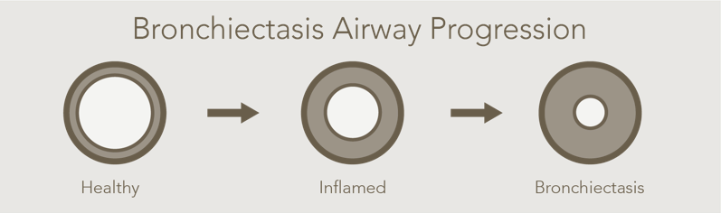 bronchiectasis resources, hfcwo therapy