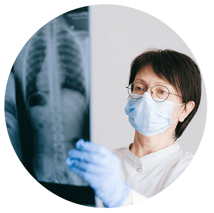 Doctor looking at x-ray image of lungs.