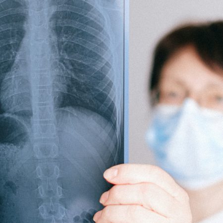 A doctor examines an x-ray