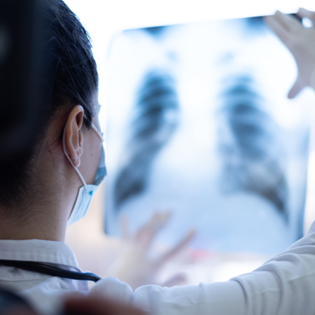 Pulmonary doctor looking at x-ray of patient's chest wall.