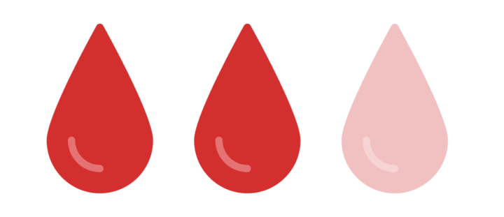 hemoptysis in bronchiectasis
