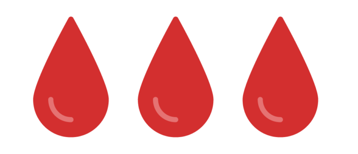 hemoptysis in bronchiectasis